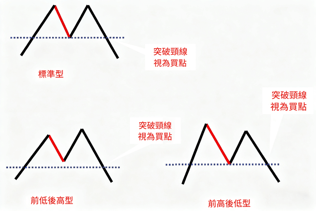 M頭型態